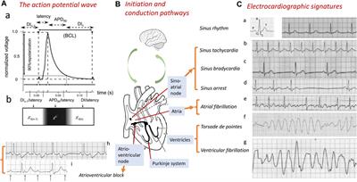 Cardiac arrhythmogenesis: roles of ion channels and their functional modification